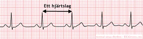 En EKG-graf. Illustration.