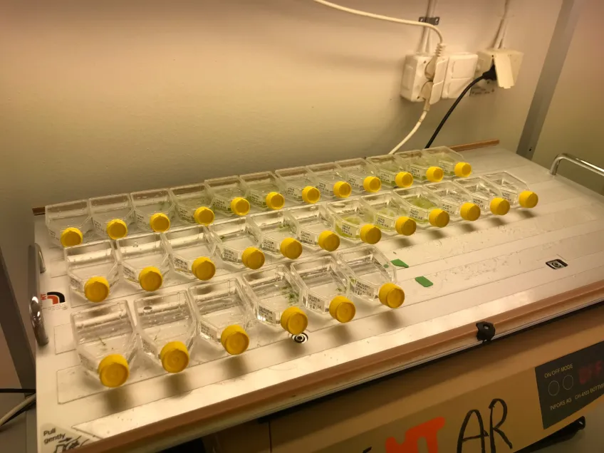 Ett flertal flaskor på ett bord. Foto.